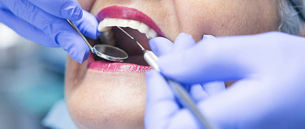 Best Emergency Root Canal Treatment in Lacey, WA